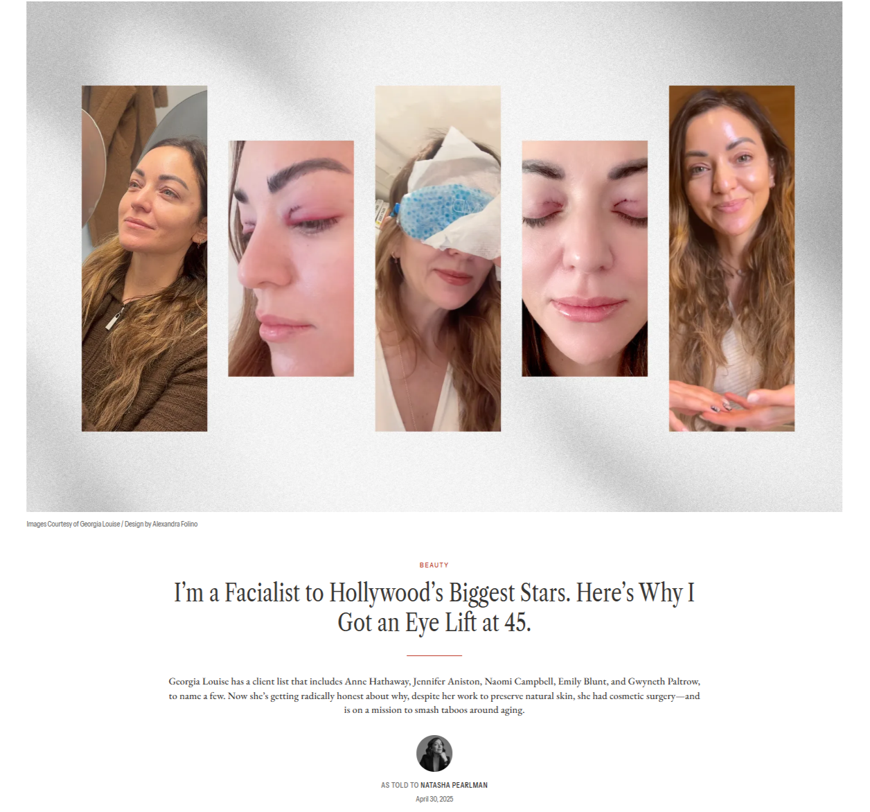 I’m a Facialist to Hollywood’s Biggest Stars. Here’s Why I Got an Eye Lift at 45.