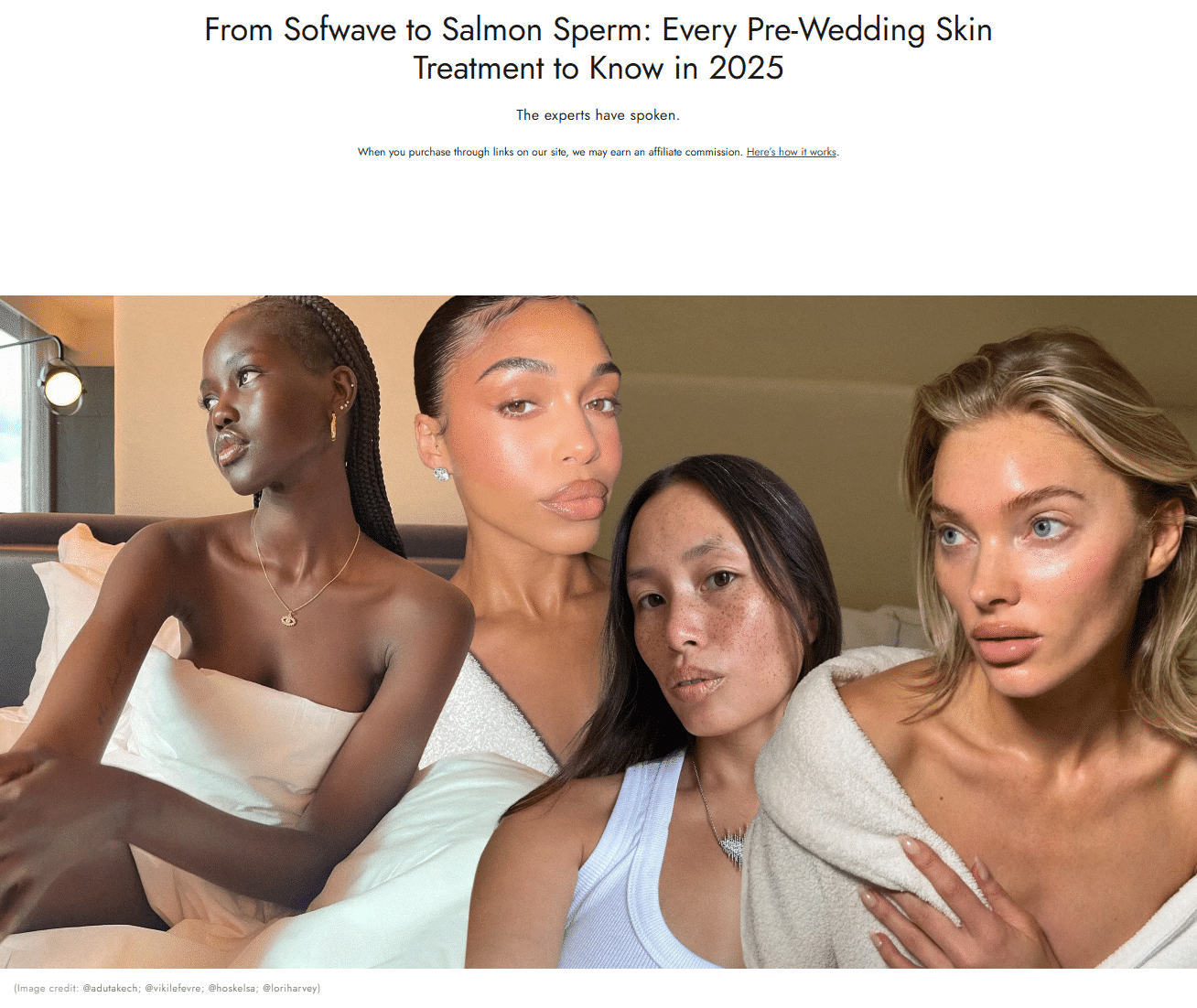 From Sofwave to Salmon Sperm: Every Pre-Wedding Skin Treatment to Know in 2025