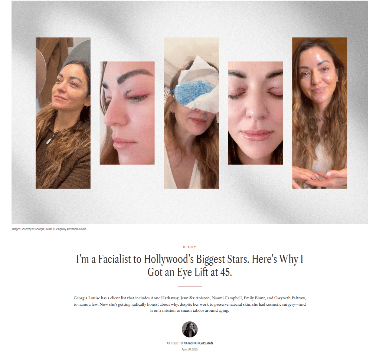 I’m a Facialist to Hollywood’s Biggest Stars. Here’s Why I Got an Eye Lift at 45.