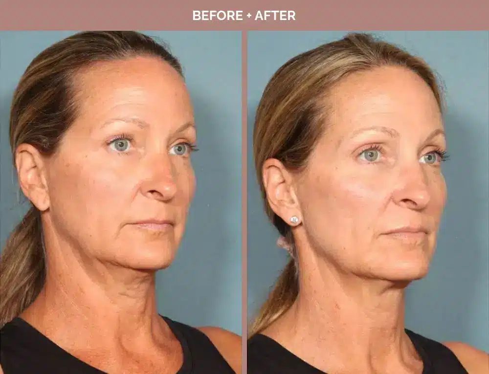 1762443651_f3a76bd2ae374fbebd3834e9bdc1d4a3