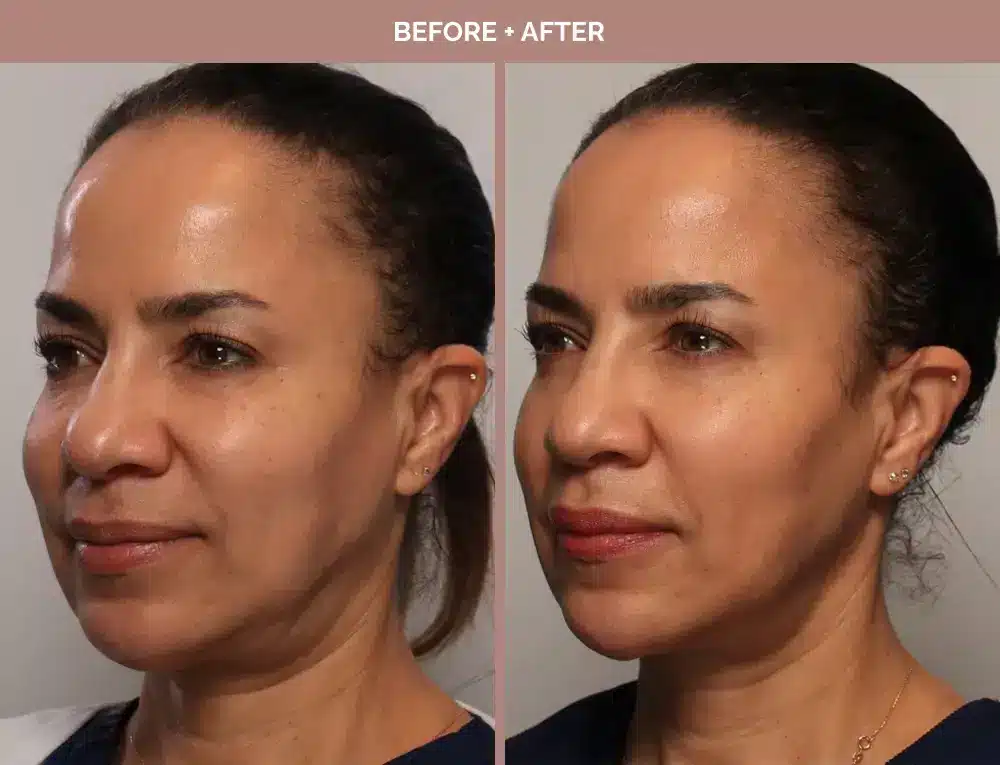 1762443655_2d3a57bd88c14c18a1f7950ace9357ab