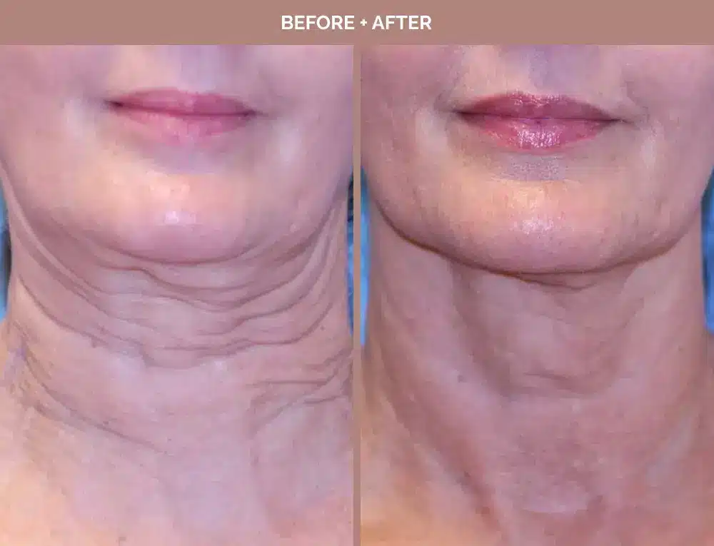 1762443658_a4f652d65fc2434093a516f3addef63e