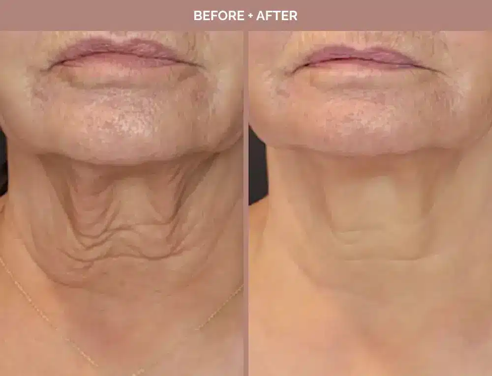 1762443661_c18a5a7de61b4e3188a9103e58c62c66