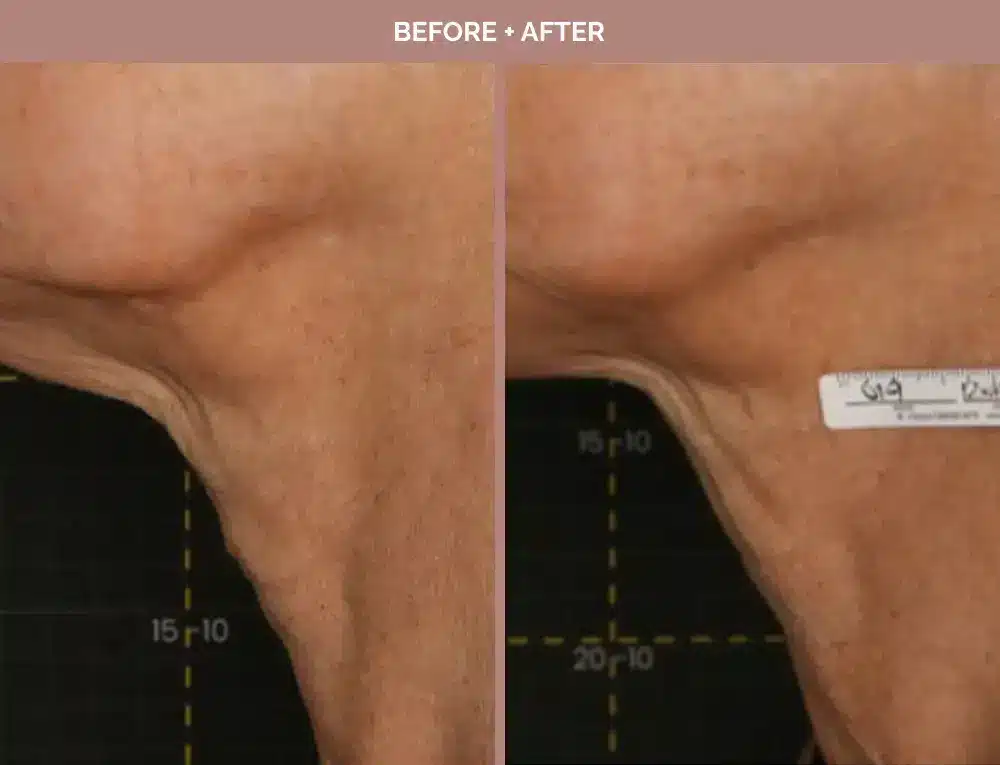 1762443665_97be6cc7a2854099b0d3870c56fd1b71