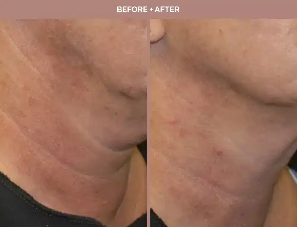 1762443668_d93b3d81d3cd4739ae964dbccb6e55d9